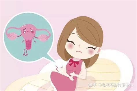 小穴位置|女性科普丨外阴 ·阴唇阴蒂…… ，你对自己了解多。